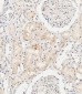 COL8A2 Antibody (C-term)